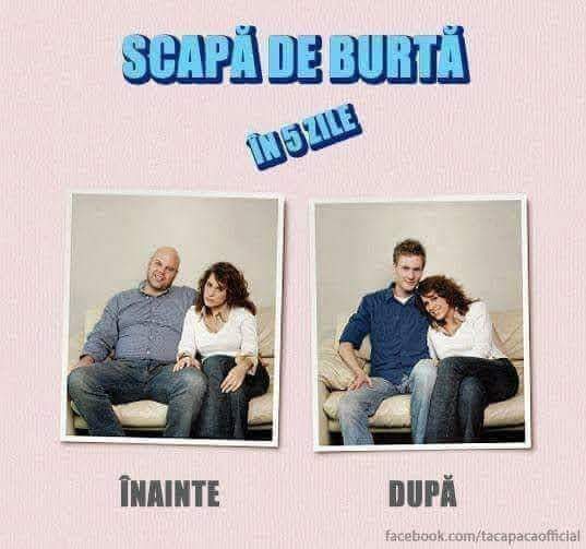 before after scapa de burta